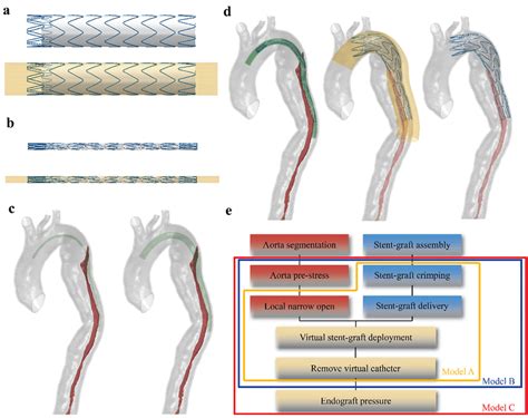 endovascular stent graft of compressed fabric and metal tube|aortic stent design.